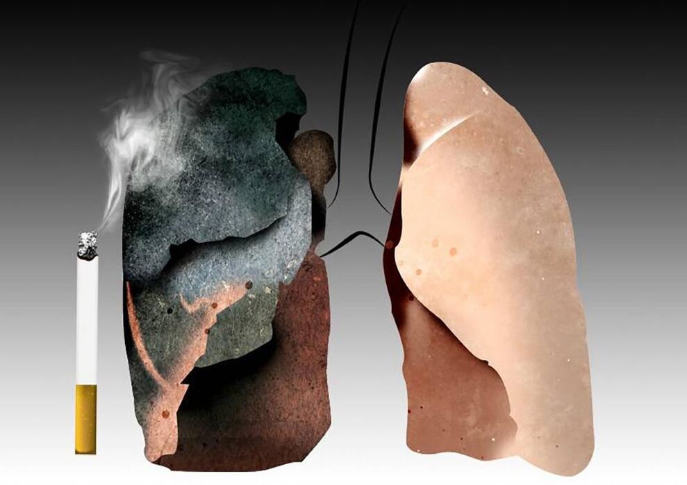 Como afecta o tabaquismo ao corpo